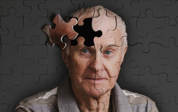 alzheimer
