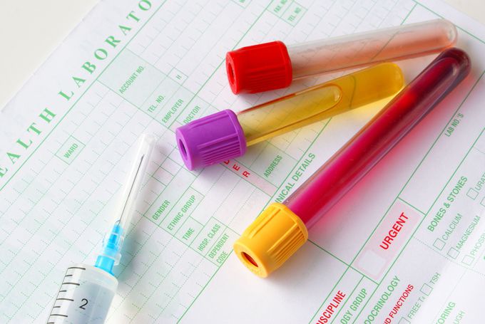Analize medicale recomandate sa se faca anual