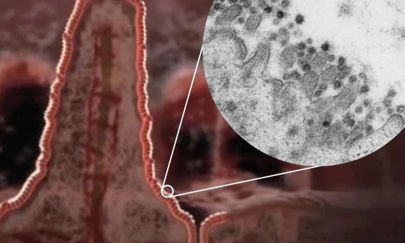 Coronavirusul SARS-CoV-2 infectează si celulele intestinelor