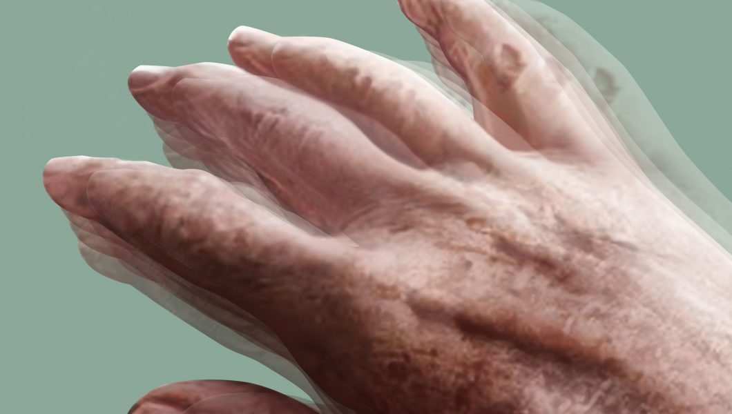 Informatii pe care trebuie sa le cunosti despre Parkinson