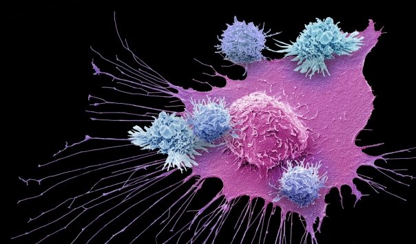 Orice tip de cancer ar putea fi diagnosticat printr-un test de respiratie