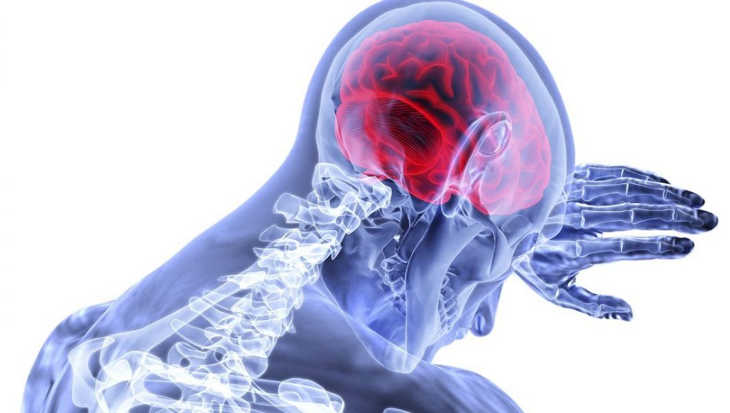 Semnele unui accident vascular cerebral