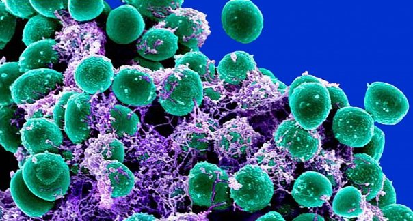 Staphylococcus epidermidis