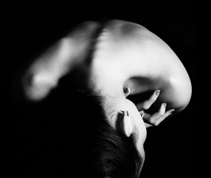 Anorexia nervoasa, o boala grava care face multe victime