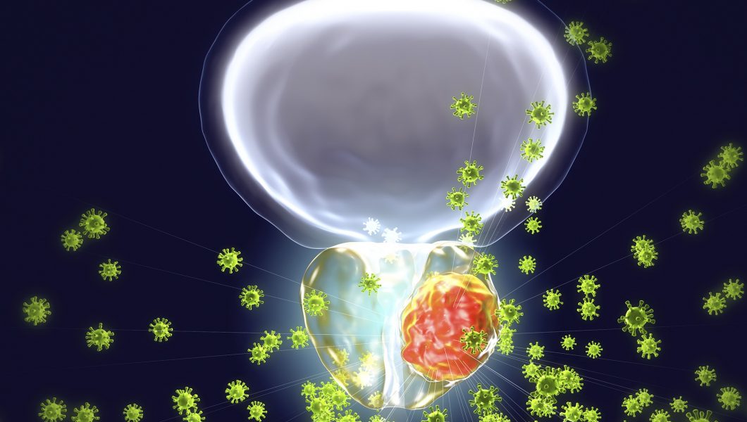 Cancer de prostata: Numarul de urinari zilnice poate fi un semnal de alarma