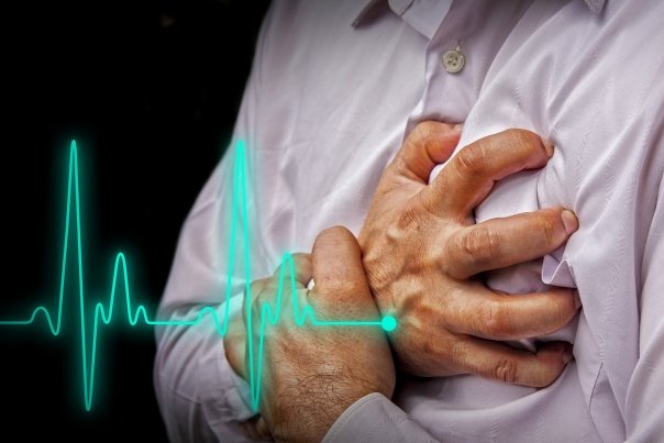 infarct miocardic
