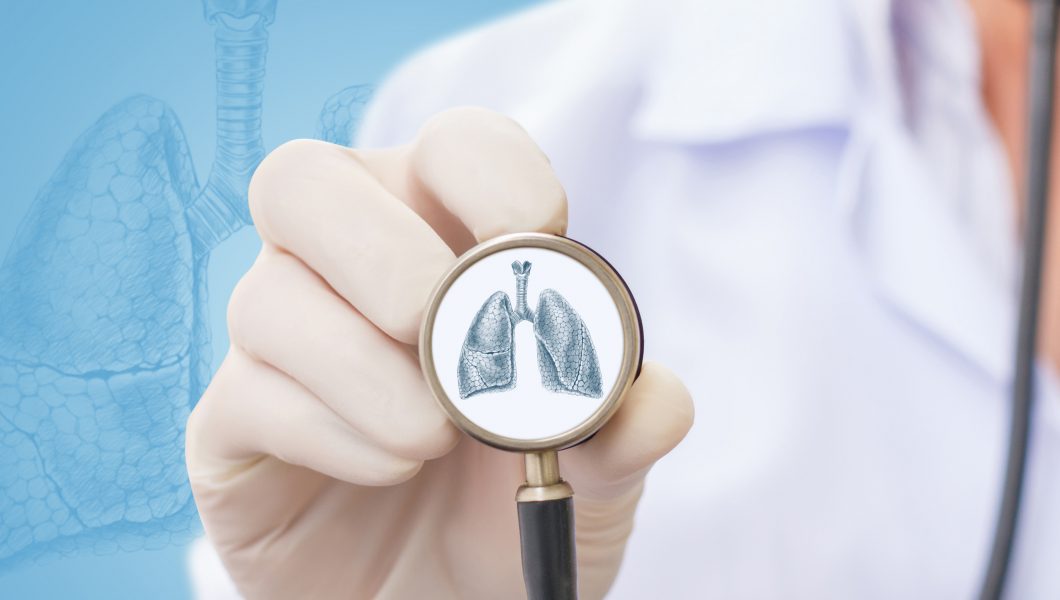 Screeningul pentru cancerul pulmonar. Cine ar trebui sa se testeze