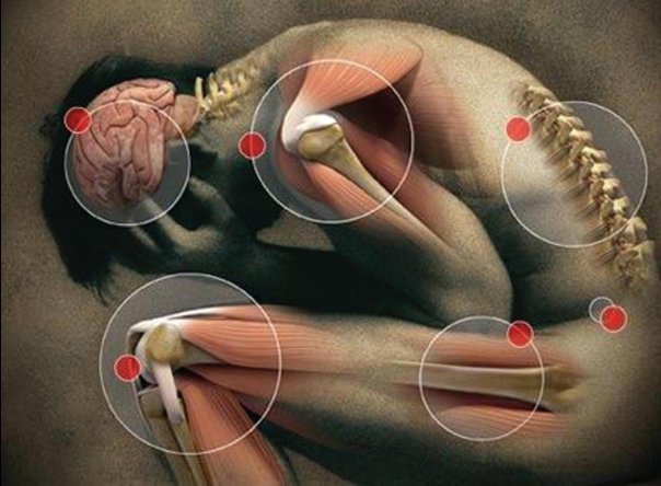 reumatism