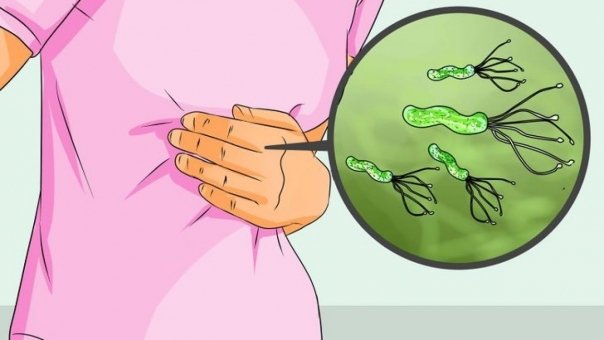 Remediul care poate ucide bacteriile din stomac