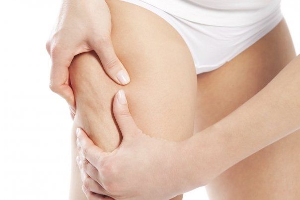 Dieta care ne poate scapa de celulita
