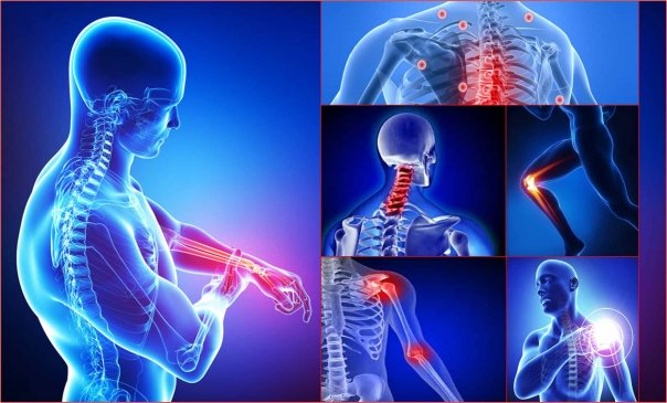 Remedii care combat durerile de muschi si articulatii