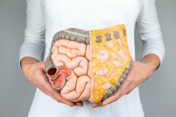 Cum recunoastem si cum tratam sindromul intestinului iritabil
