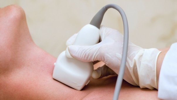 Semne care arata ca tiroida ta produce prea multi hormoni