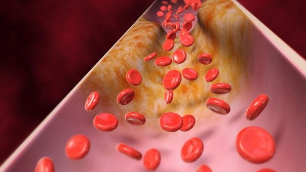 Ce este bine sa stim despre metabolismul lipoproteinelor