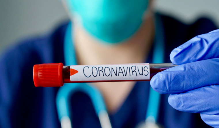 Test masurare imunitate persoane vindecate covid19