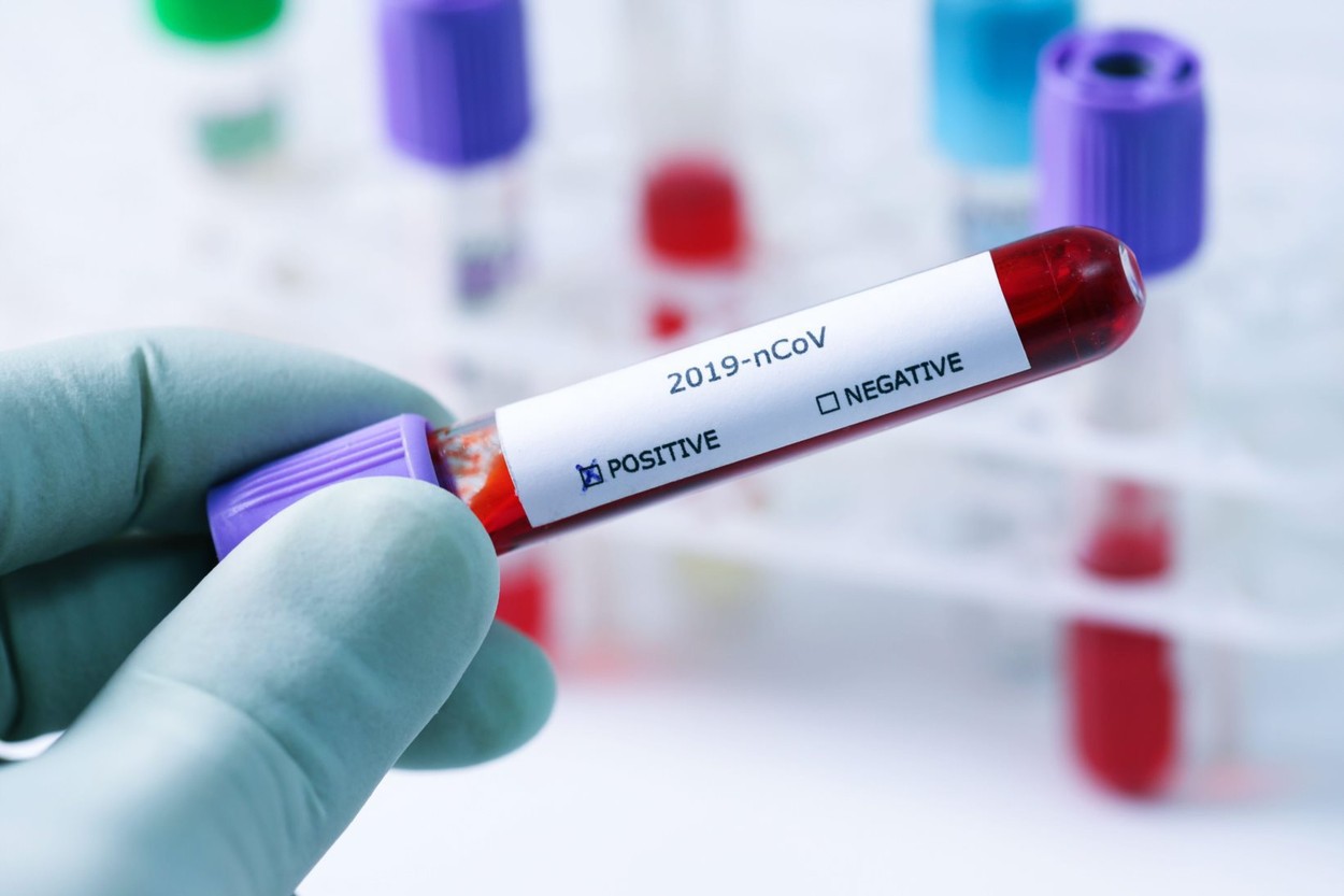 Pacientii vindecati de coronavirus depistati din nou pozitivi